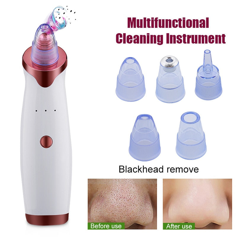 Electric Acne Remover Point Noir Blackhead Vacuum Extractor Tool Black Spots Pore Cleaner Skin Care Facial Pore Cleaner Machine