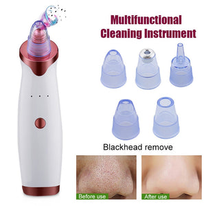 Electric Acne Remover Point Noir Blackhead Vacuum Extractor Tool Black Spots Pore Cleaner Skin Care Facial Pore Cleaner Machine